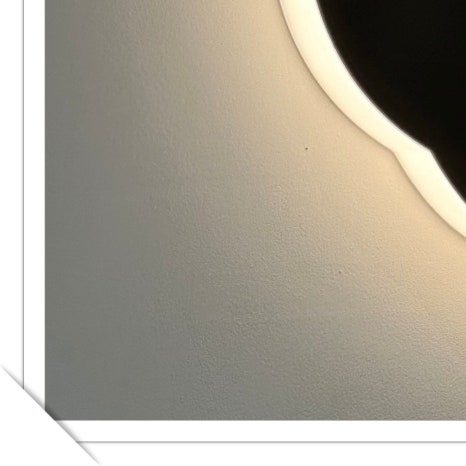 용산동임플란트 나에게 맞는 과정으로 관련 이미지 10