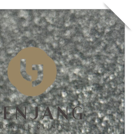 이빨씌우는가격 종류별 차이 관련 이미지 6