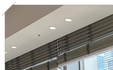 청파동임플란트 선택 고민된다면 관련 이미지 4