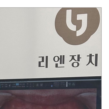 스케일링주기 치과 보험까지 확인 관련 이미지 5