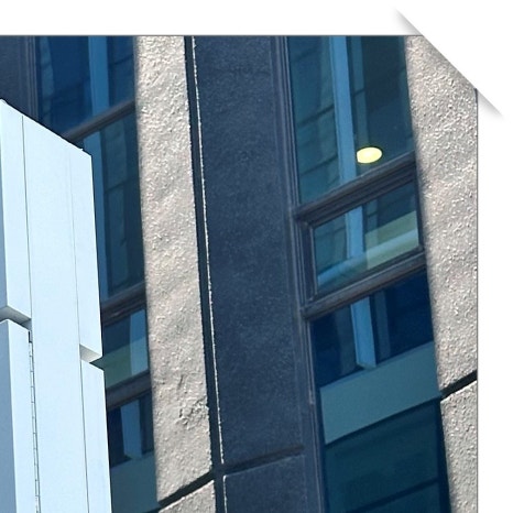 행당동임플란트 시간 때문에 고민이라면 관련 이미지 6