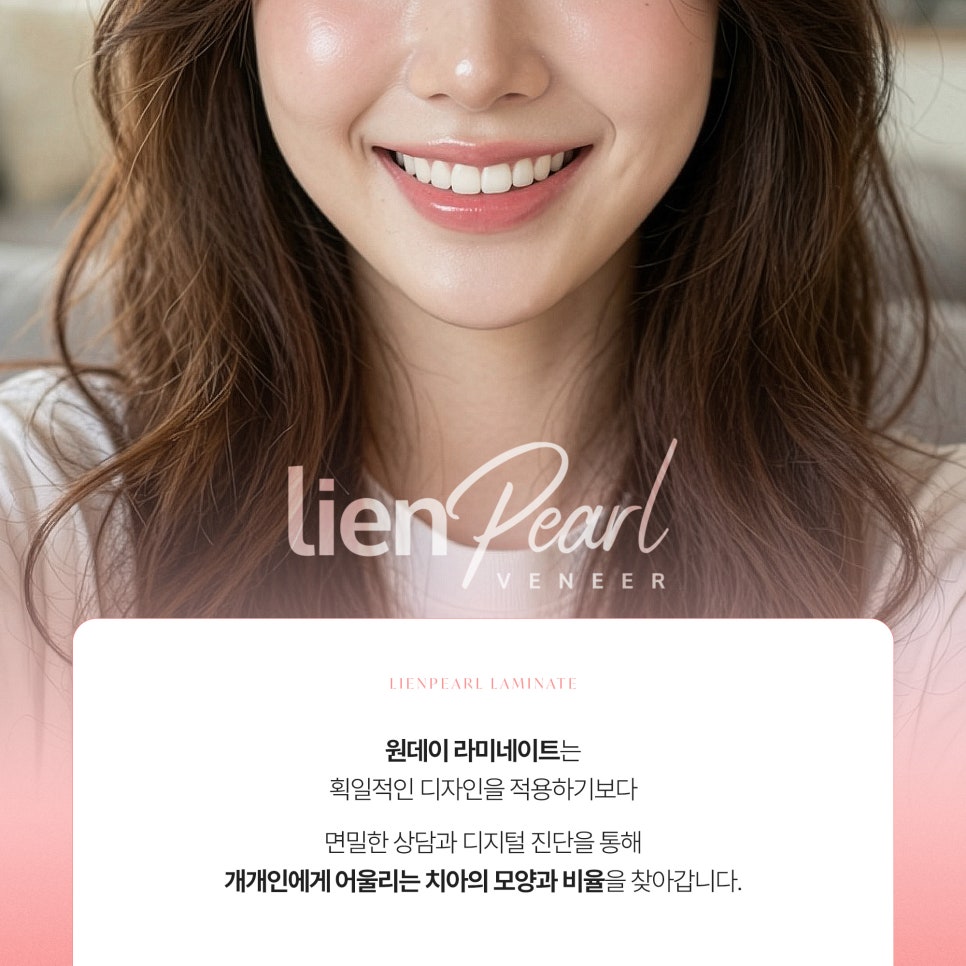 원데이 라미네이트, 하루 만에 자연스러운 결과도 가능할까요? 관련 이미지 5