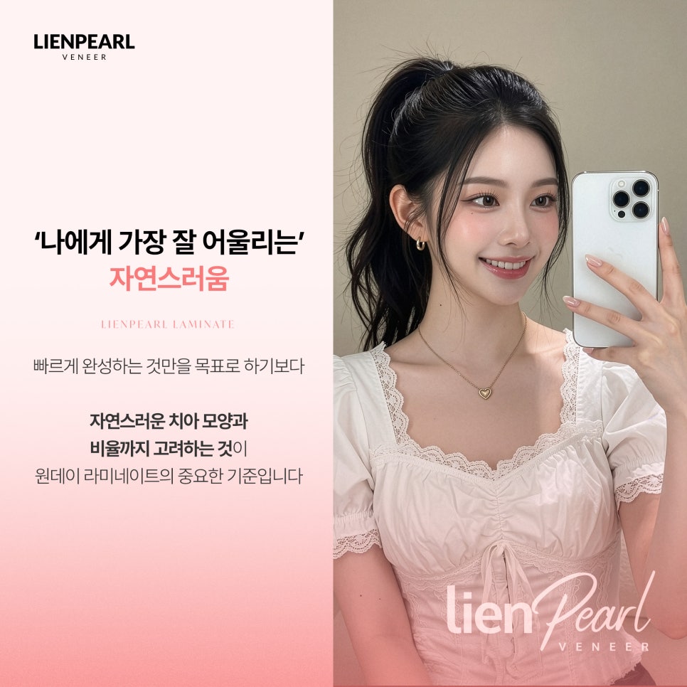 원데이 라미네이트, 하루 만에 자연스러운 결과도 가능할까요? 관련 이미지 7