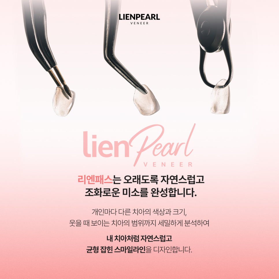 라미네이트 교정 고민될 때, 리엔패스로 살펴봐야 할 것! 관련 이미지 5