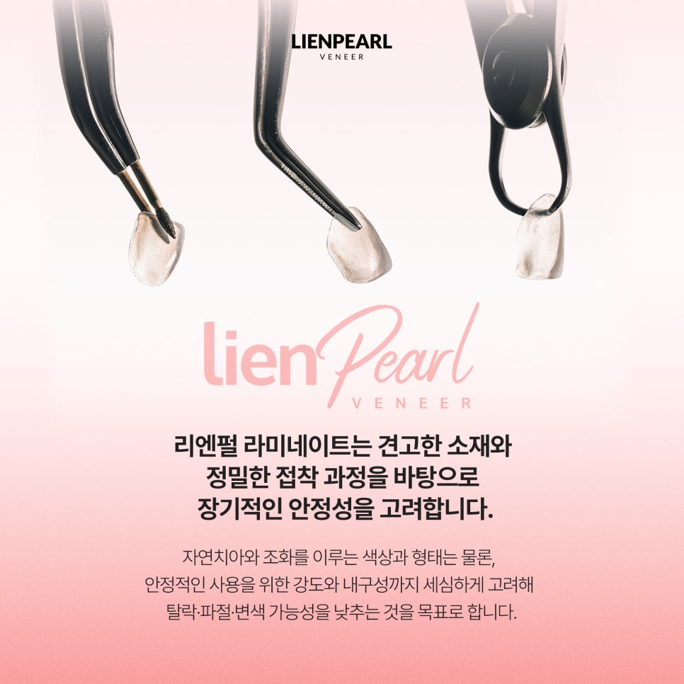 강남역 치아 라미네이트 선택 전 꼭 확인해야 할 기준 관련 이미지 5