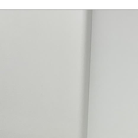 자석틀니 기존 의치 불편했다면 관련 이미지 4