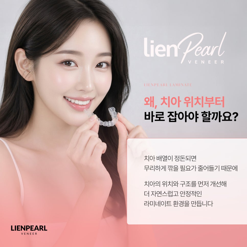 치아 배열부터 바로잡는 리엔패스 라미네이트 관련 이미지 3