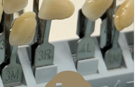 한강로동임플란트 앞니부터 어금니까지 꼼꼼하게 관련 이미지 9