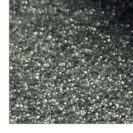 갑자기이빨아플때 원인과 치료 과정 관련 이미지 9