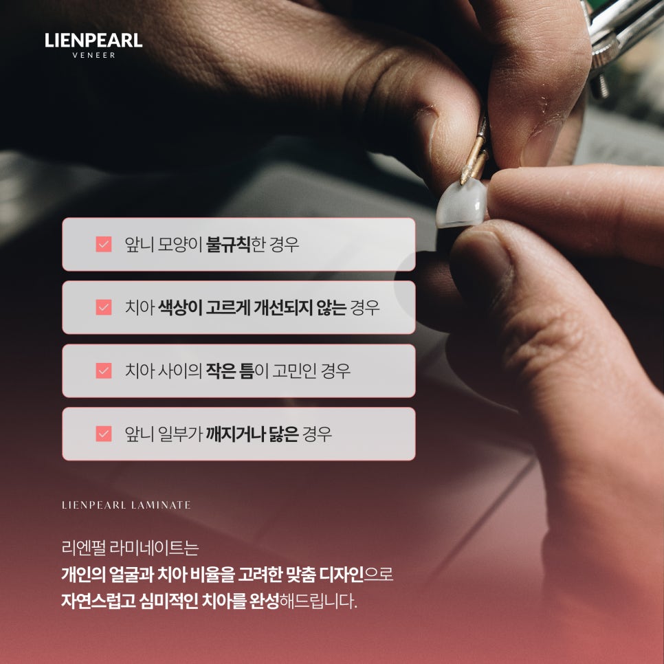 강남 라미네이트 잘하는 곳을 찾고 있다면? 자연스러운 미소를 위한 포인트 체크! 관련 이미지 6