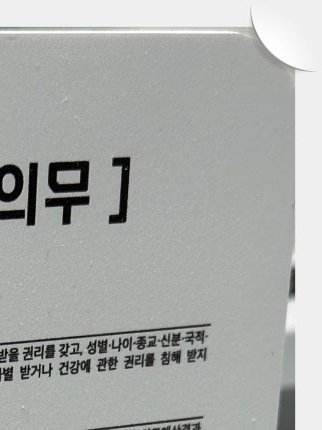 장충동임플란트 주위염 예방하고 건강하게 관련 이미지 24