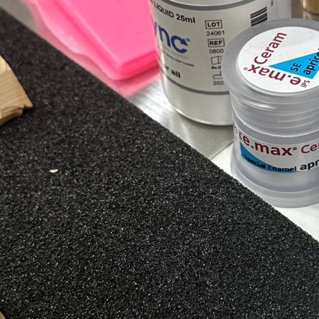 사랑니 수면마취 후기 궁금하다면 관련 이미지 7