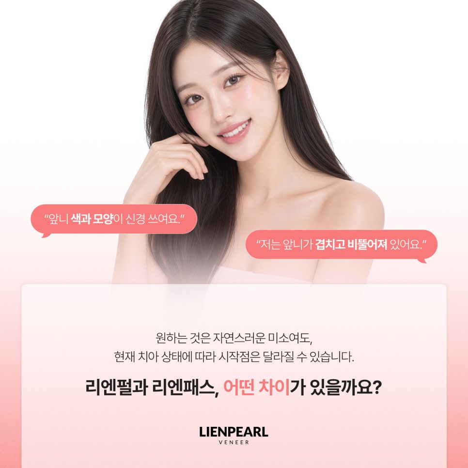 강남구 라미네이트 받기 전에 꼭 확인해야 할 3가지! 관련 이미지 2