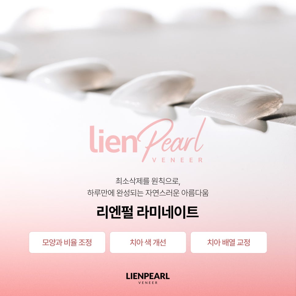 치과 라미네이트, 자연스러움은 디테일에서 시작됩니다 관련 이미지 2