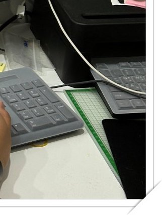 장충동임플란트 주위염 예방하고 건강하게 관련 이미지 21