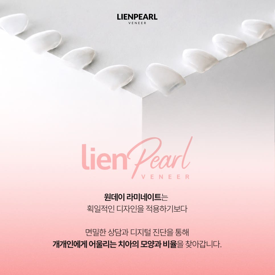 하루 만에 가능할까? 강남 원데이 라미네이트 체크포인트! 관련 이미지 4