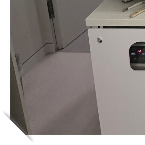 역삼치아미백 및 라미네이트 고민이라면 관련 이미지 9