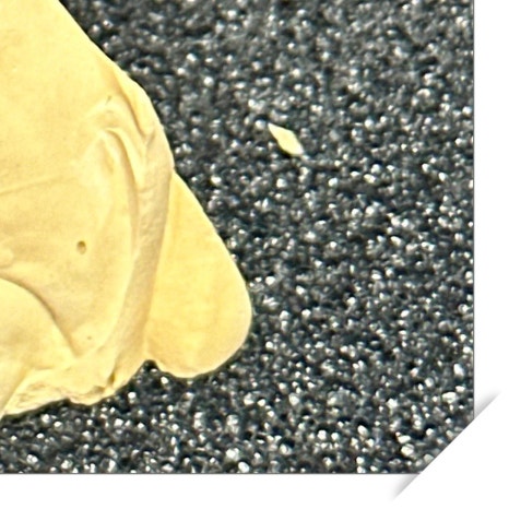 이빨씌우는가격 종류별 차이 관련 이미지 12