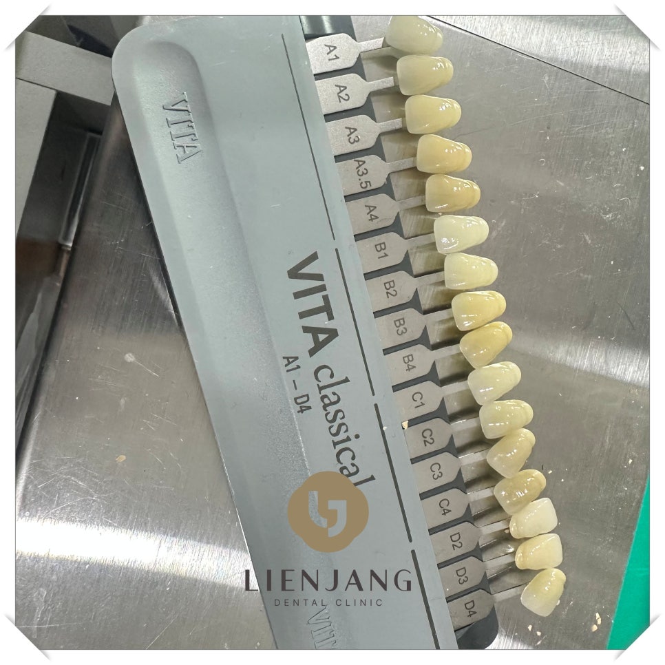 송정동임플란트 편안한 회복을 위해 관련 이미지 3