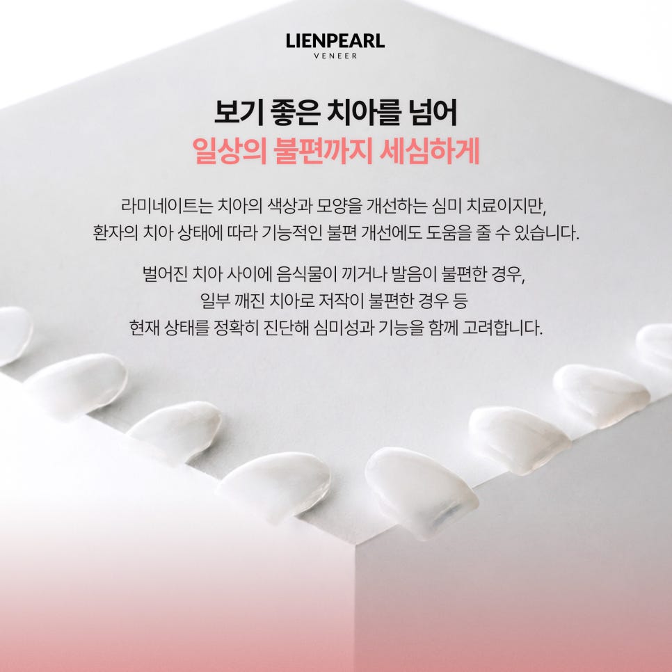 라미네이트 치과 추천, 자연스러운 미소를 위한 리엔펄 디자인 관련 이미지 7