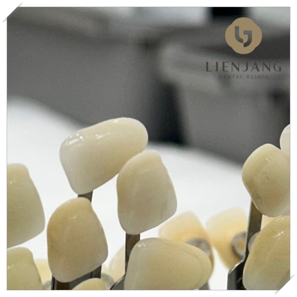 이촌동임플란트 잘하는 곳 찾으려면 관련 이미지 3