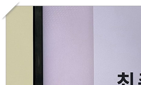 보광동임플란트 앞니도 자연스럽게 관련 이미지 4