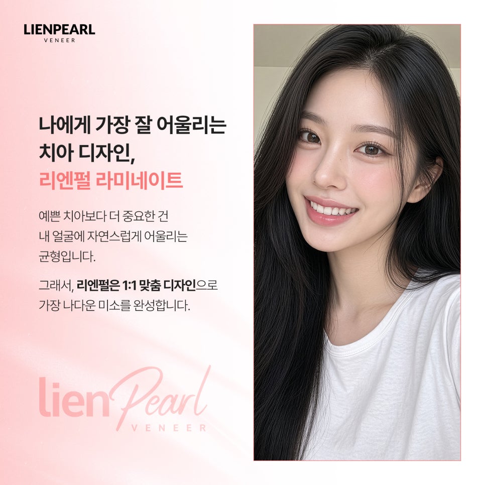 내 얼굴에 맞는 라미네이트 방법, 리엔장치과 리엔펄! 관련 이미지 2