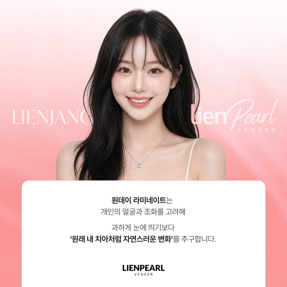 원데이 라미네이트, 하루 만에 자연스러운 결과도 가능할까요? 관련 이미지 3