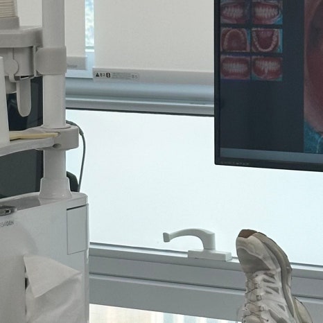 스케일링주기 치과 보험까지 확인 관련 이미지 7