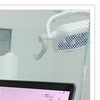 장충동임플란트 주위염 예방하고 건강하게 관련 이미지 6