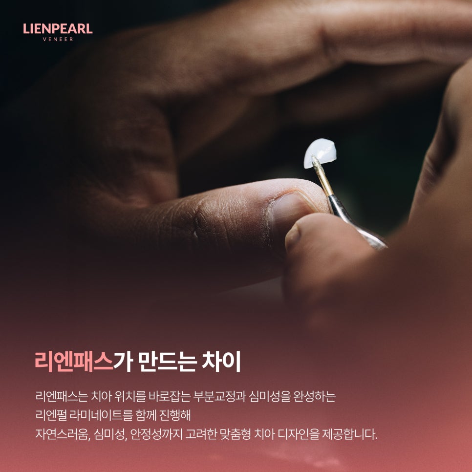 연예인 라미네이트 비교, 나도 이렇게 될 수 있을까? 관련 이미지 7