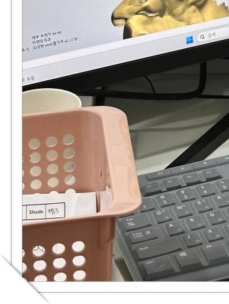 장충동임플란트 주위염 예방하고 건강하게 관련 이미지 19