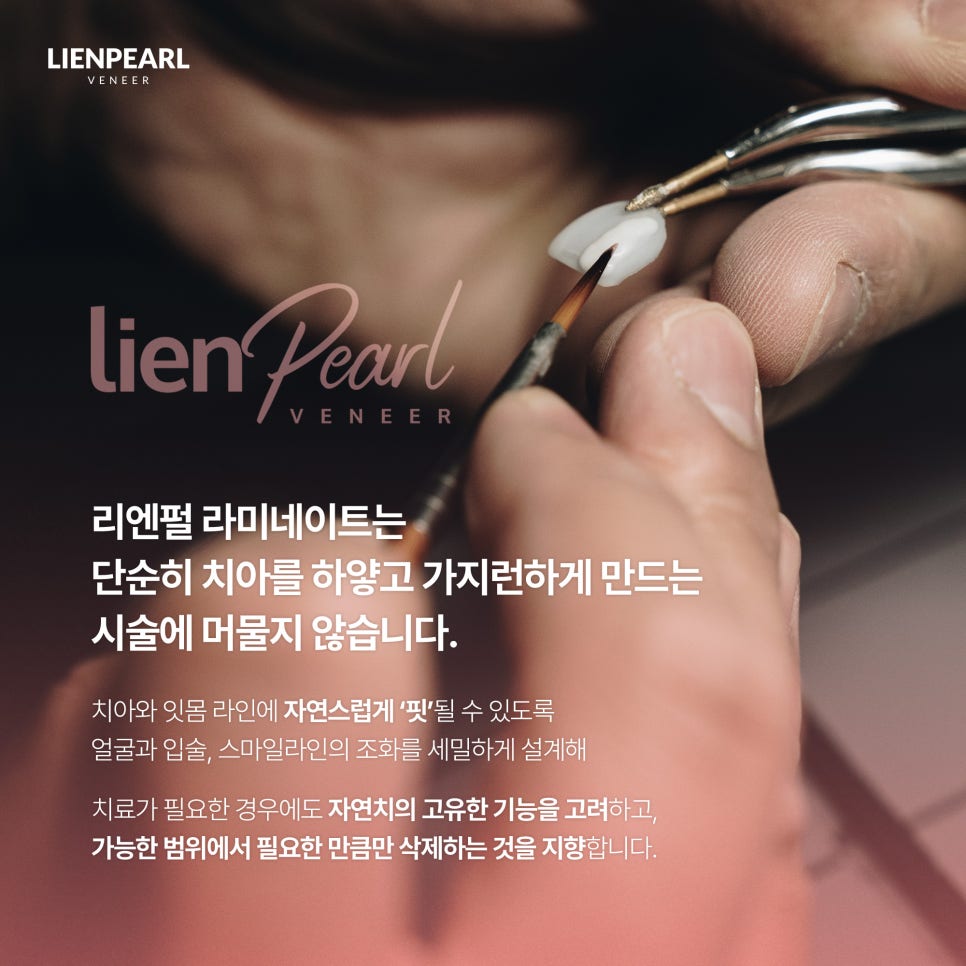 라미네이트 유지기간이 궁금하다면? 관련 이미지 4