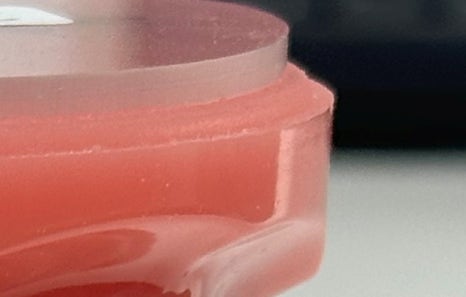 연희임플란트 디지털 네비게이션과 3D 기술로 안전하고 정밀하게 관련 이미지 5