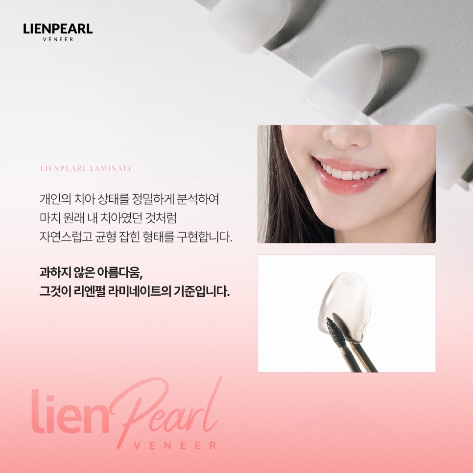 라미네이트 종류부터 맞춤 디자인까지, 나에게 어울리는 선택 방법 관련 이미지 4