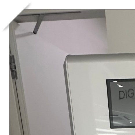 역삼치아미백 및 라미네이트 고민이라면 관련 이미지 3