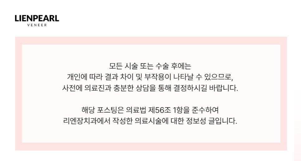 라미네이트 유지기간이 궁금하다면? 관련 이미지 11