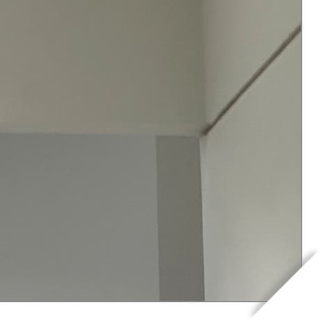 이촌동임플란트 잘하는 곳 찾으려면 관련 이미지 12