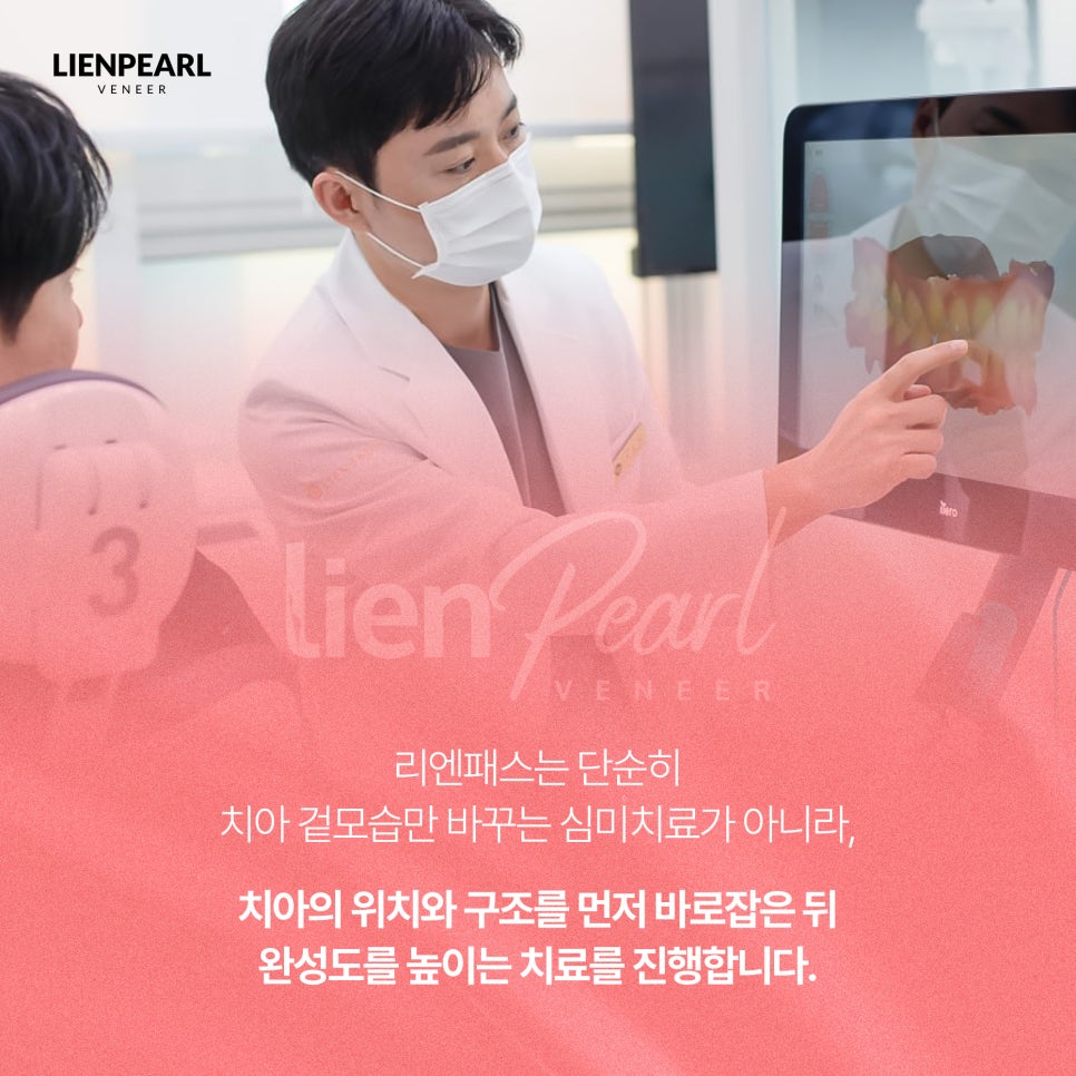 라미네이트 기간, 교정이 필요한 경우 얼마나 걸릴까? 관련 이미지 7