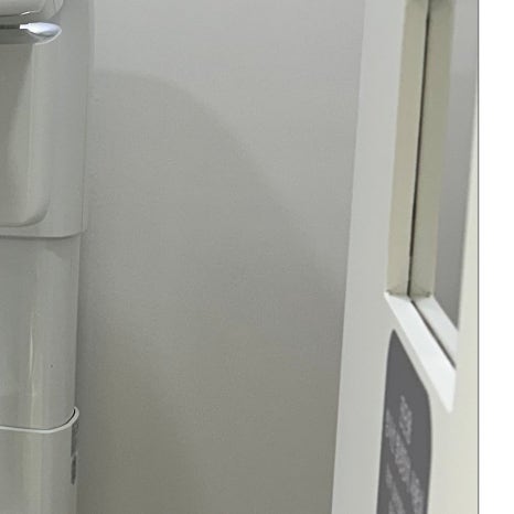 이빨교정 전후 맞춤형 과정으로 관련 이미지 8