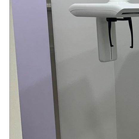 이빨교정 전후 맞춤형 과정으로 관련 이미지 6