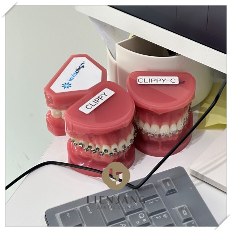 리엔장치과 의식하 진정법으로 편안하게 관련 이미지 6