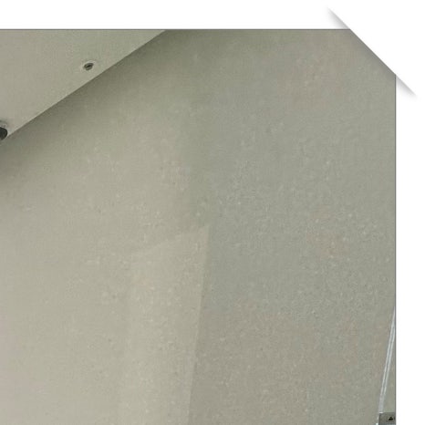 돌출입수술가격 종류에 따라 구분해야 관련 이미지 5