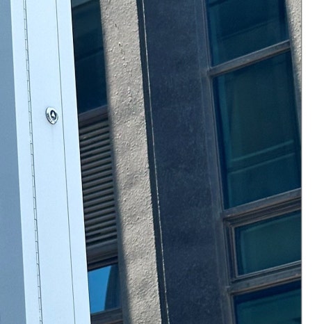 행당동임플란트 시간 때문에 고민이라면 관련 이미지 9