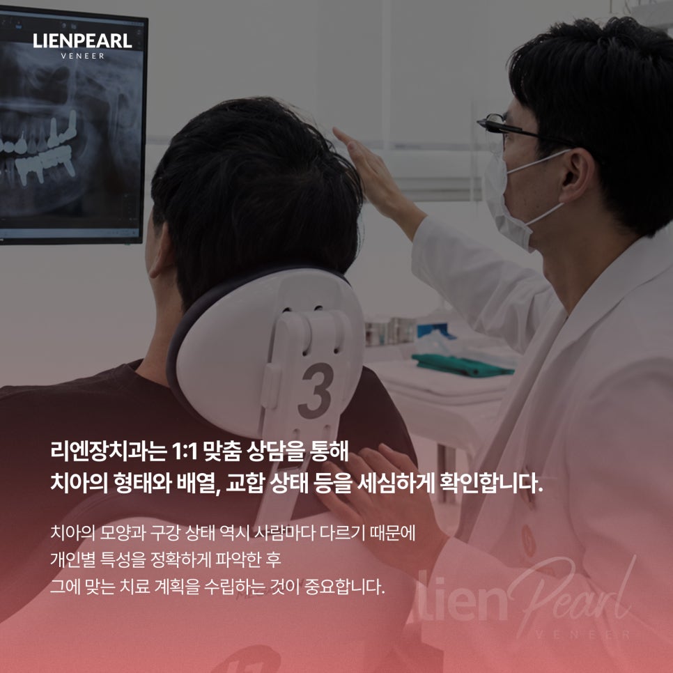 라미네이트 수명, 오래 유지하려면 무엇이 중요할까요? 관련 이미지 7