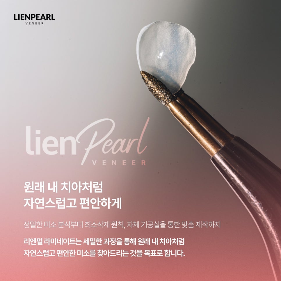 라미네이트 치아 삭제가 걱정된다면, 먼저 확인해야 할 것! 관련 이미지 7