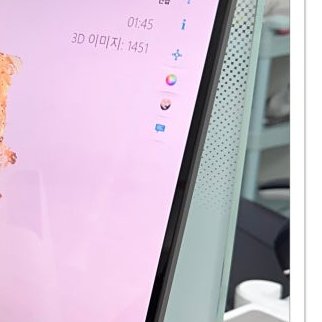 장충동임플란트 주위염 예방하고 건강하게 관련 이미지 9