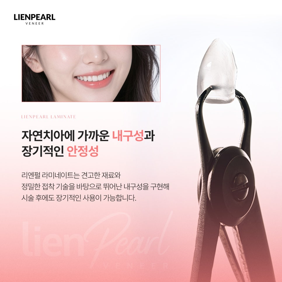 Rien Pearl Veneers: A Choice for a Natural Smile That Lasts Over Time image 5