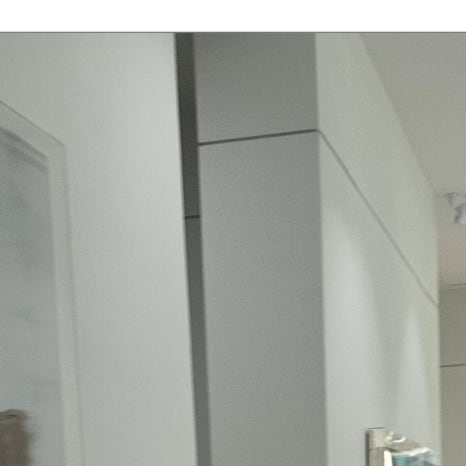 용답동임플란트 뼈 이식까지 고려한다면 관련 이미지 5