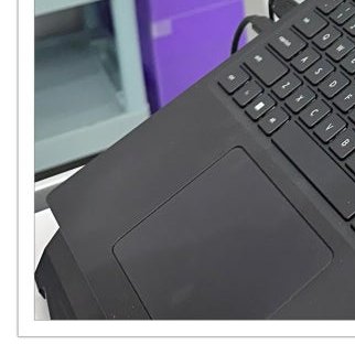 장충동임플란트 주위염 예방하고 건강하게 관련 이미지 10